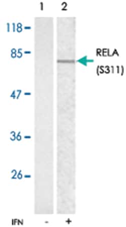 RELA (phospho S311), Rabbit anti-Human, Mouse, Rat, Polyclonal Antibody, Abnova 100 &mu;g | Buy Online | Abnova Corporation | Fisher Scientific