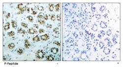 RELA (phospho S311), Rabbit anti-Human, Mouse, Rat, Polyclonal Antibody, Abnova 100 &mu;g | Buy Online | Abnova Corporation | Fisher Scientific