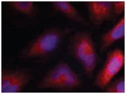 MARCKS (phospho S162), Rabbit anti-Human, Mouse, Rat, Polyclonal Antibody, Abnova 100 &mu;g | Buy Online | Abnova Corporation | Fisher Scientific