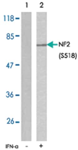 NF2 (phospho S518), Rabbit anti-Human, Mouse, Rat, Polyclonal Antibody,