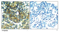 RPS6KB1 (phospho S411), Rabbit anti-Human, Mouse, Rat, Polyclonal Antibody, Abnova 100 &mu;g | Buy Online | Abnova | Fisher Scientific