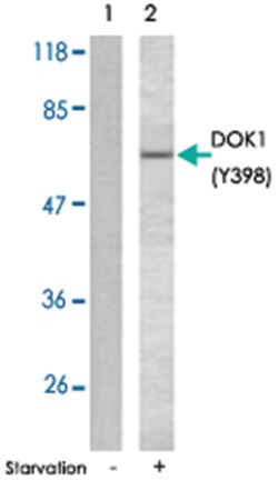DOK1 (phospho Y398), Rabbit anti-Human, Mouse, Rat, Polyclonal Antibody,