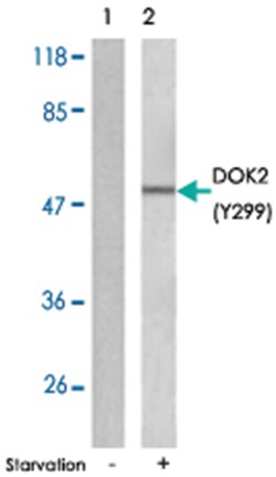 DOK2 (phospho Y299), Rabbit anti-Human, Polyclonal Antibody, Abnova 100 &mu;g | Buy Online | Abnova Corporation | Fisher Scientific