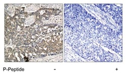 DOK2 (phospho Y299), Rabbit anti-Human, Polyclonal Antibody, Abnova 100 &mu;g | Buy Online | Abnova Corporation | Fisher Scientific