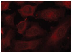 DOK2 (phospho Y299), Rabbit anti-Human, Polyclonal Antibody, Abnova 100 &mu;g | Buy Online | Abnova Corporation | Fisher Scientific