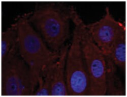 SNCA (phospho Y133), Rabbit anti-Human, Mouse, Rat, Polyclonal Antibody,