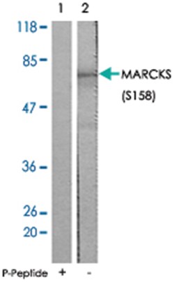 MARCKS (phospho S158), Rabbit anti-Human, Mouse, Rat, Polyclonal Antibody, Abnova 100 &mu;g | Buy Online | Abnova Corporation | Fisher Scientific