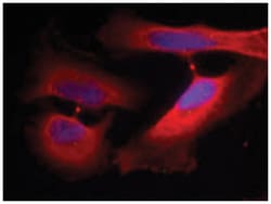 KRT8 (phospho S74), Rabbit anti-Human, Polyclonal Antibody, Abnova 100 &mu;g | Buy Online | Abnova Corporation | Fisher Scientific