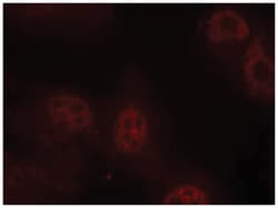 MYC (phospho S62), Rabbit anti-Human, Mouse, Rat, Polyclonal Antibody,