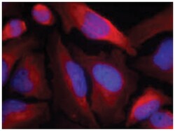 TH (phospho S19), Rabbit anti-Human, Rat, Polyclonal Antibody, Abnova 100&mu;g;
