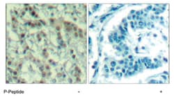 AURKA (phospho T288), Rabbit anti-Human, Mouse, Polyclonal Antibody, Abnova