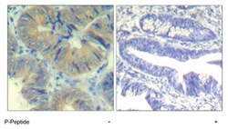 CHEK2 (phospho S33), Rabbit anti-Human, Polyclonal Antibody, Abnova 100 &mu;g | Buy Online | Abnova Corporation | Fisher Scientific