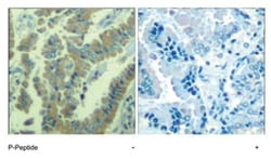 MARCKS (phospho S170), Rabbit anti-Human, Polyclonal Antibody, Abnova 100&mu;g;