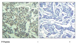 KIT (phospho Y936), Rabbit anti-Human, Polyclonal Antibody, Abnova 100 &mu;g | Buy Online | Abnova Corporation | Fisher Scientific