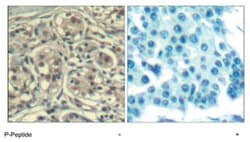 CCNE1 (phospho T395), Rabbit anti-Human, Polyclonal Antibody, Abnova 100 &mu;g | Buy Online | Abnova Corporation | Fisher Scientific