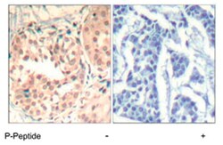 CDK6 (phospho Y13), Rabbit anti-Human, Mouse, Polyclonal Antibody, Abnova 100 &mu;g | Buy Online | Abnova Corporation | Fisher Scientific