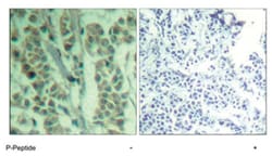 CBL (phospho Y700), Rabbit anti-Human, Polyclonal Antibody, Abnova 100&mu;g;