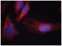 CBL (phospho Y700), Rabbit anti-Human, Polyclonal Antibody, Abnova 100&mu;g;