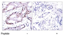 JUN Rabbit anti-Human, Mouse, Rat, Polyclonal Antibody, Abnova 100 &mu;g | Buy Online | Abnova Corporation | Fisher Scientific