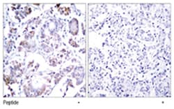 RELA Rabbit anti-Human, Mouse, Rat, Polyclonal Antibody, Abnova 100 &mu;g | Buy Online | Abnova Corporation | Fisher Scientific