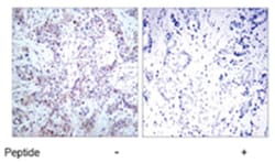 RELA Rabbit anti-Human, Mouse, Rat, Polyclonal Antibody, Abnova 100 &mu;g | Buy Online | Abnova Corporation | Fisher Scientific