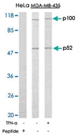 NFKB2 Rabbit anti-Human, Mouse, Rat, Polyclonal Antibody, Abnova 100 &mu;g | Buy Online | Abnova Corporation | Fisher Scientific