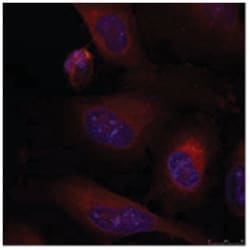 JUNB Rabbit anti-Human, Mouse, Rat, Polyclonal Antibody, Abnova 100 &mu;g | Buy Online | Abnova Corporation | Fisher Scientific