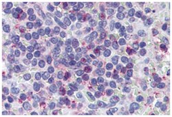 LTB4R Rabbit anti-Human, Polyclonal Antibody, Abnova 50 &mu;g | Buy Online | Abnova | Fisher Scientific