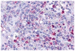 LTB4R Rabbit anti-Hamster, Horse, Human, Monkey, Mouse, Rabbit, Rat, Polyclonal Antibody, Abnova 50 &mu;g | Buy Online | Abnova Corporation | Fisher Scientific