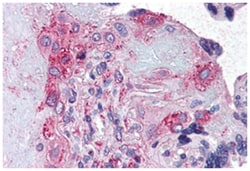 ADAMTS5 Rabbit anti-Human, Monkey, Polyclonal Antibody, Abnova 50&mu;g;