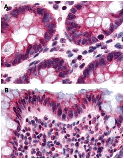 O3FAR1 Rabbit anti-Human, Polyclonal Antibody, Abnova 50 &mu;g | Buy Online | Abnova Corporation | Fisher Scientific