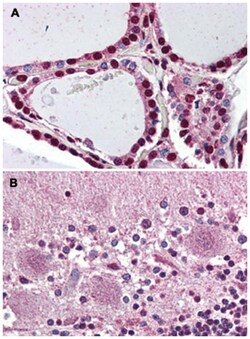 PROKR2 Rabbit anti-Human, Monkey, Polyclonal Antibody, Abnova 50 &mu;g | Buy Online | Abnova Corporation | Fisher Scientific