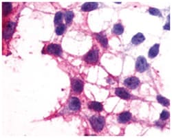 P2RY12 Rabbit anti-Human, Polyclonal Antibody, Abnova 50 &mu;g | Buy Online | Abnova Corporation | Fisher Scientific