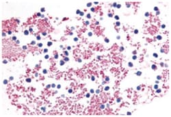 P2RY12 Rabbit anti-Human, Polyclonal Antibody, Abnova 50 &mu;g | Buy Online | Abnova Corporation | Fisher Scientific