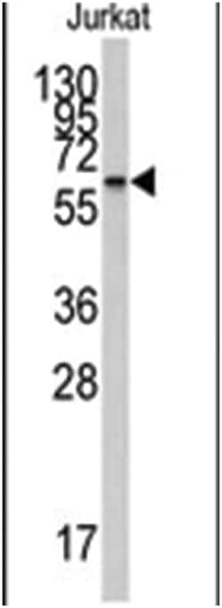 CYP26A1, Rabbit, Polyclonal Antibody, Abnova 400 &mu;L | Buy Online | Abnova Corporation | Fisher Scientific