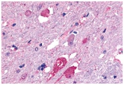 GALR2, Rabbit, Polyclonal Antibody, Abnova 50&mu;g; Unlabeled:Antibodies,