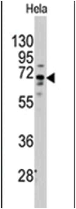 FZD1 Rabbit anti-Human, Polyclonal Antibody, Abnova 400 &mu;L | Buy Online | Abnova Corporation | Fisher Scientific