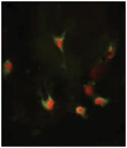 FZD1 Rabbit anti-Human, Polyclonal Antibody, Abnova 400 &mu;L | Buy Online | Abnova Corporation | Fisher Scientific