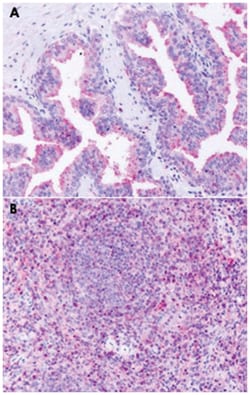 GPR63 Rabbit anti-Bovine, Hamster, Human, Mouse, Pig, Rat, Polyclonal Antibody, Abnova 50 &mu;g | Buy Online | Abnova Corporation | Fisher Scientific