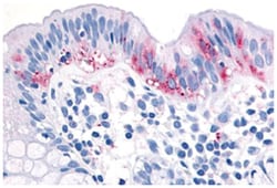 MAP3K8 Rabbit anti-Bovine, Dog, Human, Monkey, Polyclonal Antibody, Abnova 50 &mu;g | Buy Online | Abnova Corporation | Fisher Scientific