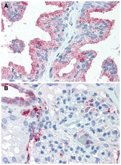 SLC39A14 Rabbit anti-Dog, Horse, Human, Pig, Polyclonal Antibody, Abnova 50 &mu;g | Buy Online | Abnova Corporation | Fisher Scientific