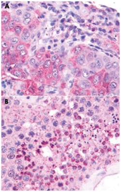 NMBR Rabbit anti-Bovine, Horse, Human, Mouse, Pig, Rabbit, Polyclonal Antibody, Abnova 50 &mu;g | Buy Online | Abnova Corporation | Fisher Scientific