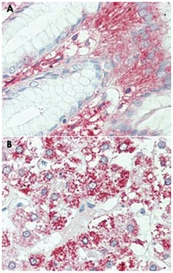 SLC7A2, Rabbit, Polyclonal Antibody, Abnova 50 &mu;g | Buy Online | Abnova Corporation | Fisher Scientific