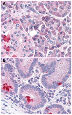 LRRN4 Rabbit anti-Human, Polyclonal Antibody, Abnova 50 &mu;g | Buy Online | Abnova Corporation | Fisher Scientific