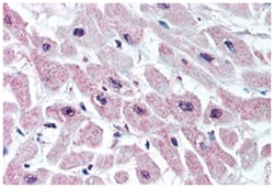 KCNJ3 Rabbit anti-Bovine, Guinea pig, Hamster, Horse, Human, Monkey, Mouse, Pig, Rat, Polyclonal Antibody, Abnova 50 &mu;g | Buy Online | Abnova Corporation | Fisher Scientific
