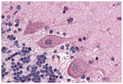 SCN1A Rabbit anti-Chicken, Dog, Hamster, Horse, Human, Monkey, Mouse, Pig, Rabbit, Rat, Polyclonal Antibody, Abnova 50 &mu;g | Buy Online | Abnova Corporation | Fisher Scientific