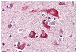 ENTPD2, Rabbit, Polyclonal Antibody, Abnova 50&mu;g; Unlabeled:Antibodies,