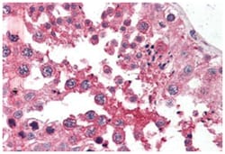 GPC4, Rabbit, Polyclonal Antibody, Abnova 50 &mu;g | Buy Online | Abnova Corporation | Fisher Scientific