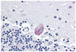 LPCAT1 Rabbit anti-Human, Polyclonal Antibody, Abnova 50 &mu;g | Buy Online | Abnova Corporation | Fisher Scientific