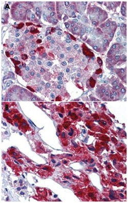 LRRN4 Rabbit anti-Human, Polyclonal Antibody, Abnova 50&mu;g; Unlabeled:Antibodies,